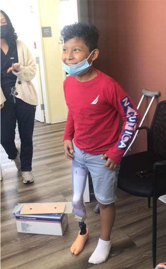OIC Patient Ambassador Efrain with his new prosthetic